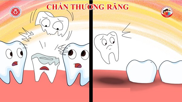Chấn thương răng - Bệnh viện răng hàm mặt Tp.HCM