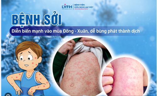 Bài truyền thông bệnh sởi