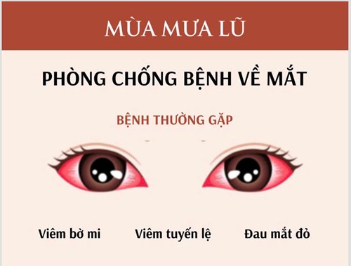 Phòng chống bệnh về mắt