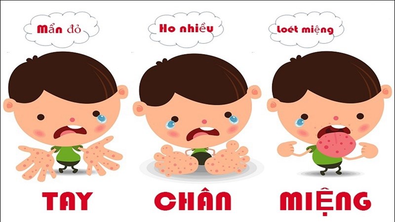 Tờ rơi cách nhận biết bệnh Tay - chân - miệng